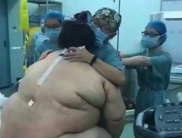 Unbelievable! It Took 16 Doctors and Nurses to Help This Overweight Mother Give Birth Safely (Photos)